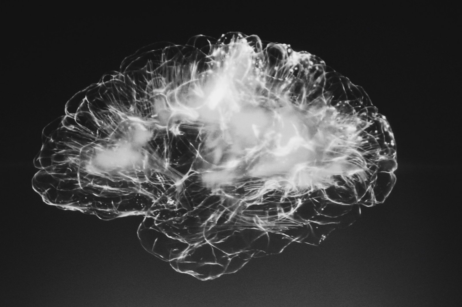 Le Cerveau Et Ses Myst res Neurofeedback Dynamique